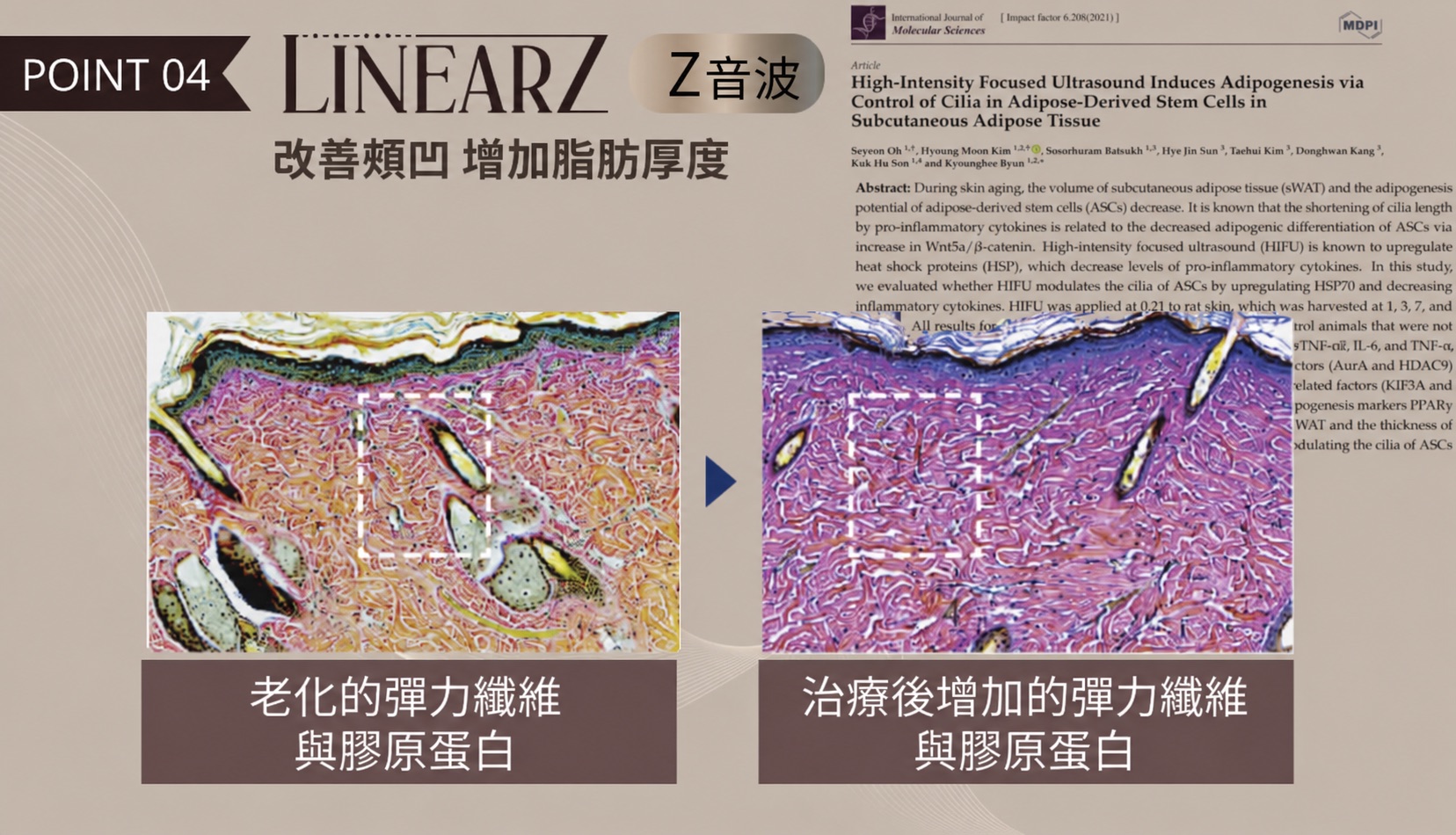 Linear Z 不同模式與組織規劃示意